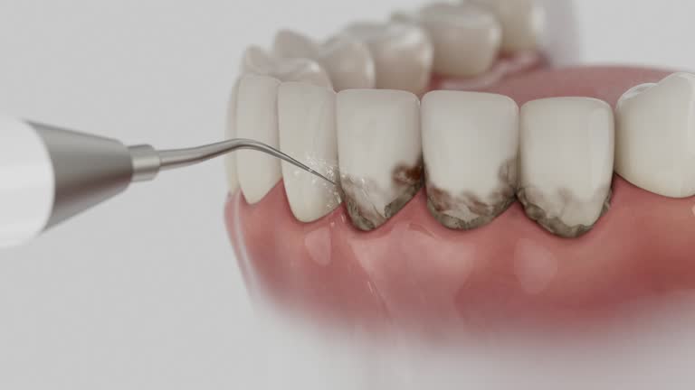 Reliable Dental Implants contractor in Kent Estates, IA by Smile Center Dentistry